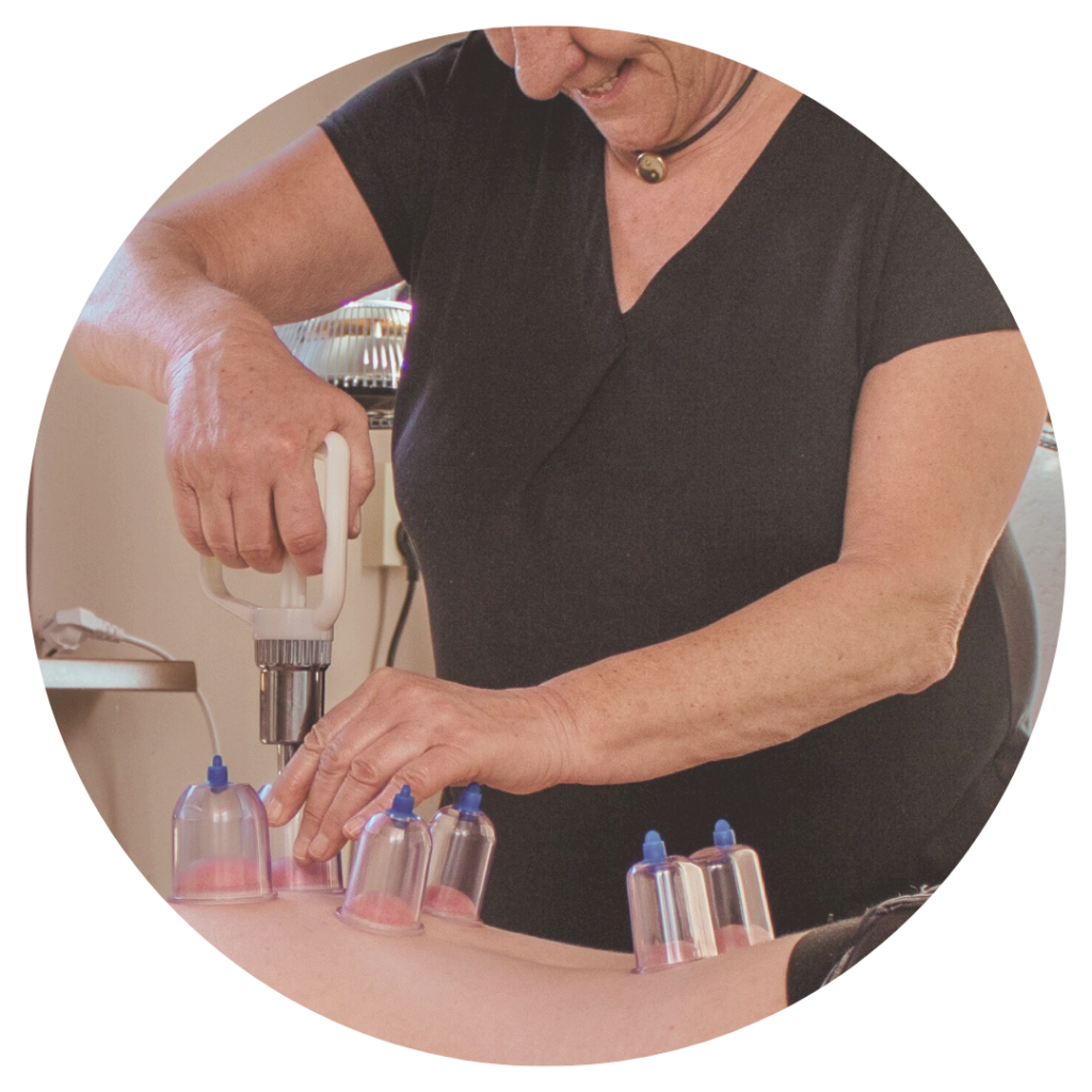 TuiNa praktijk Paula - Square - Cupping